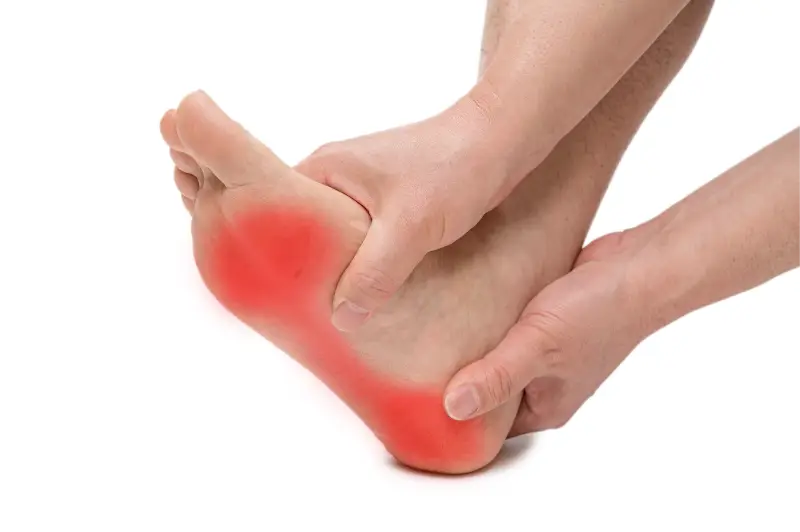 Plantar fasciitis