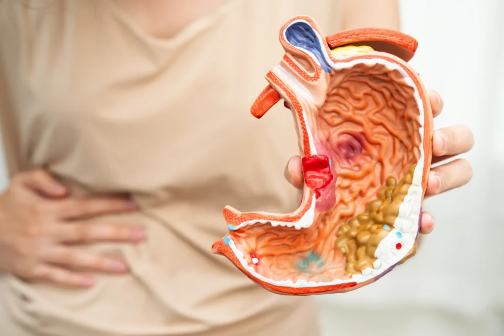 stomach disease asian woman holding anatomy model 2026 01 09 10 21 39 utc